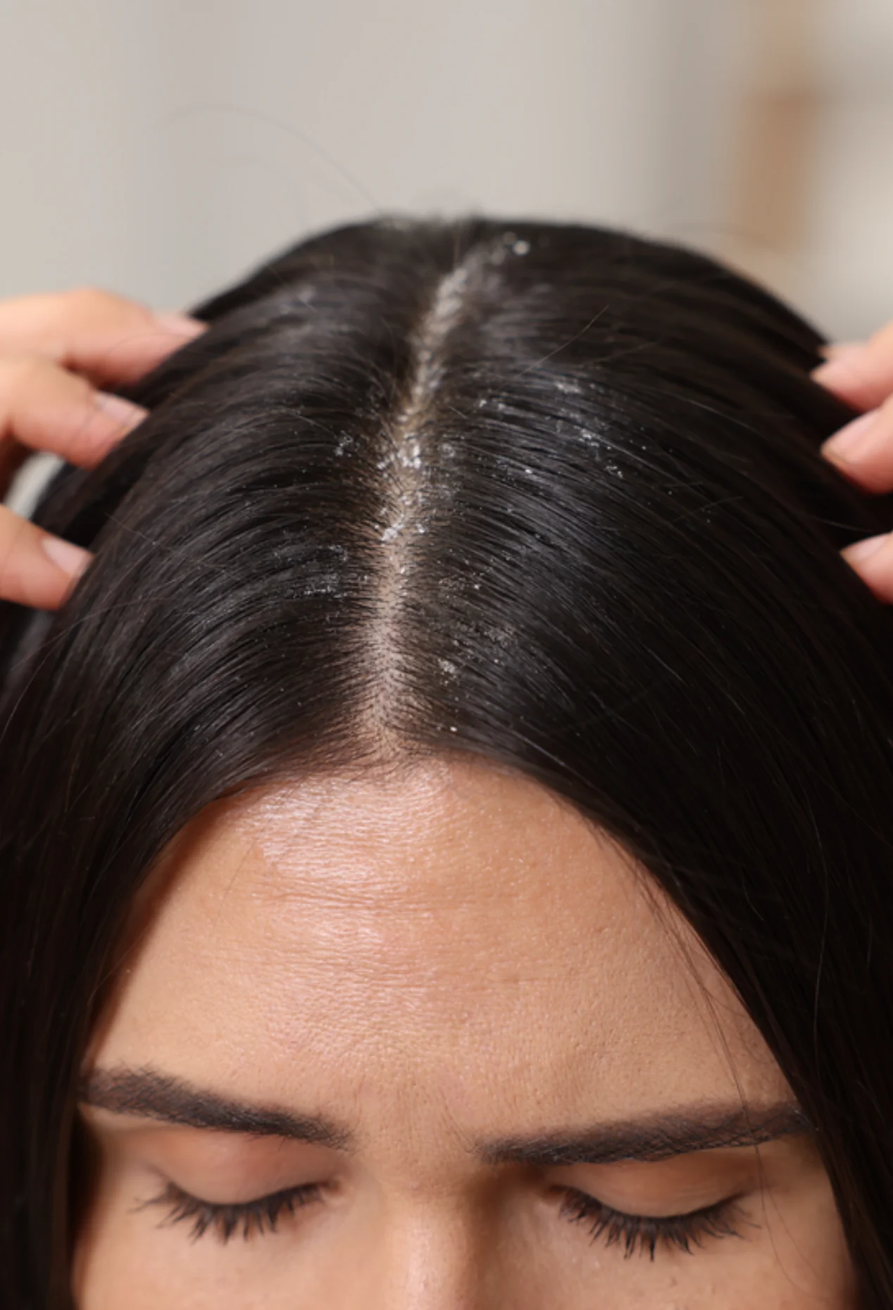 Pflegeshampoo Anti-Schuppen - Image 2